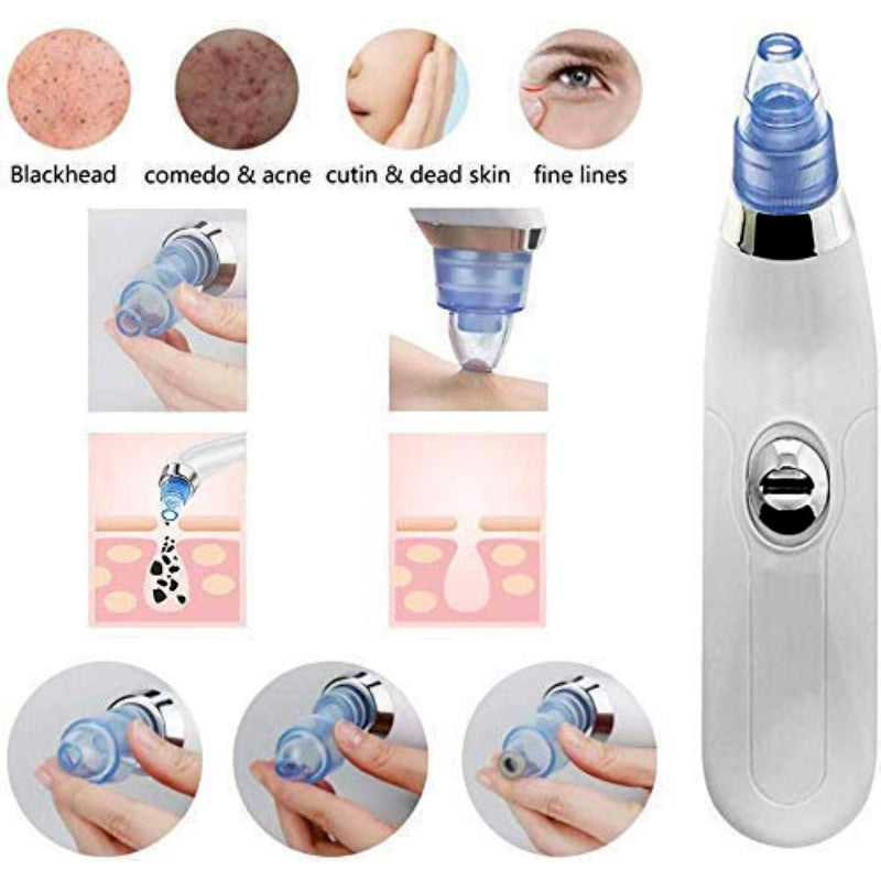 Derma suction Blackhead Remover Vacuum Acne Cleaner Black Spots Removal