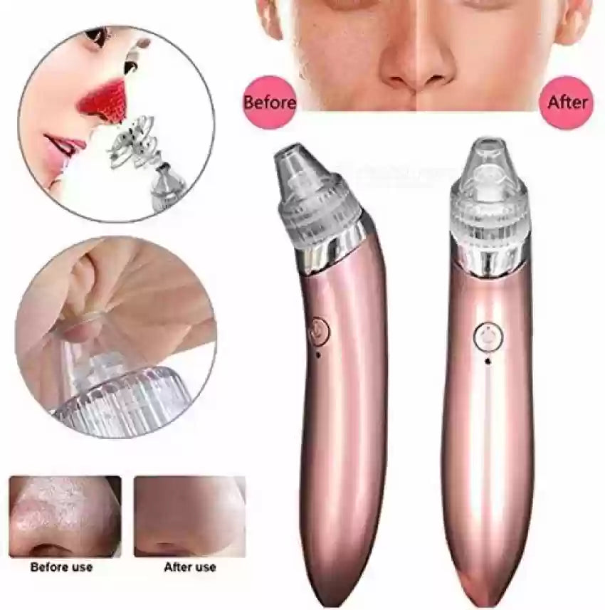 Blackhead Remover Vacuum Acne Cleaner Black Spots Removal