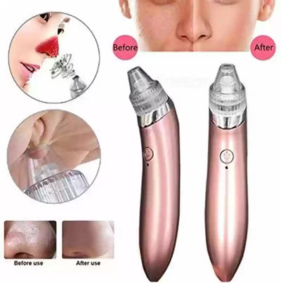 Blackhead Remover Vacuum Acne Cleaner Black Spots Removal